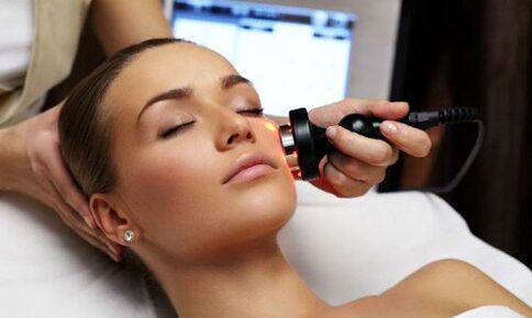 Laser rejuvenation